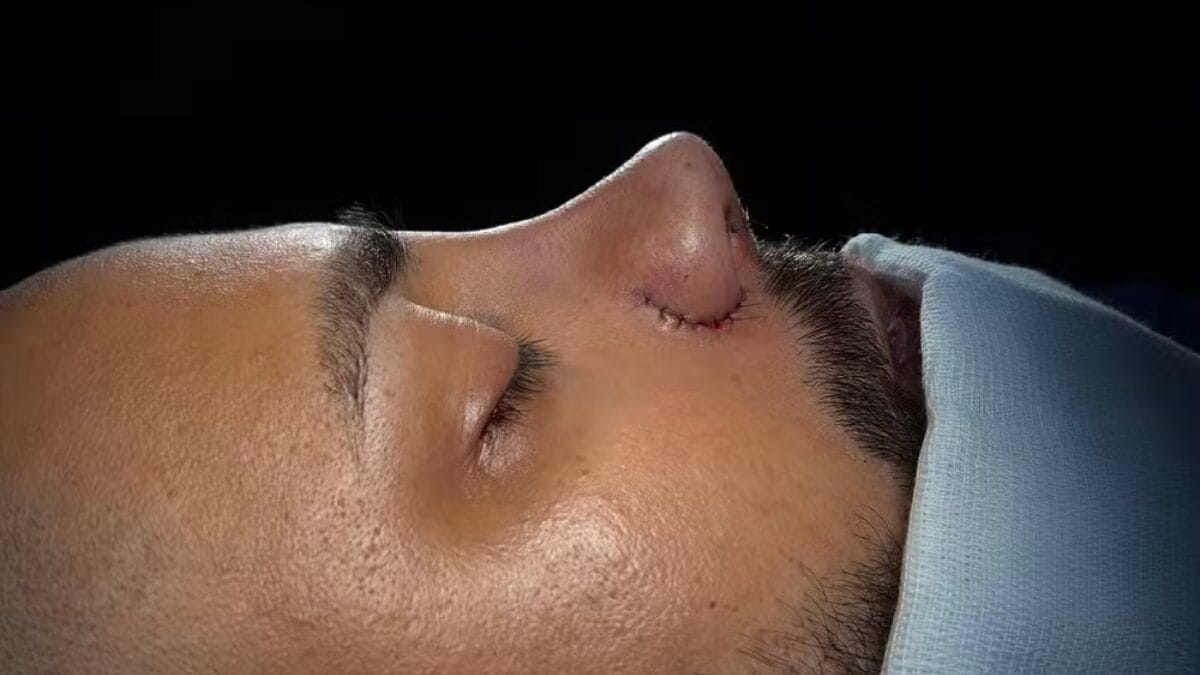 Depois da cirurgia (Foto: Reprodução, Instagram)