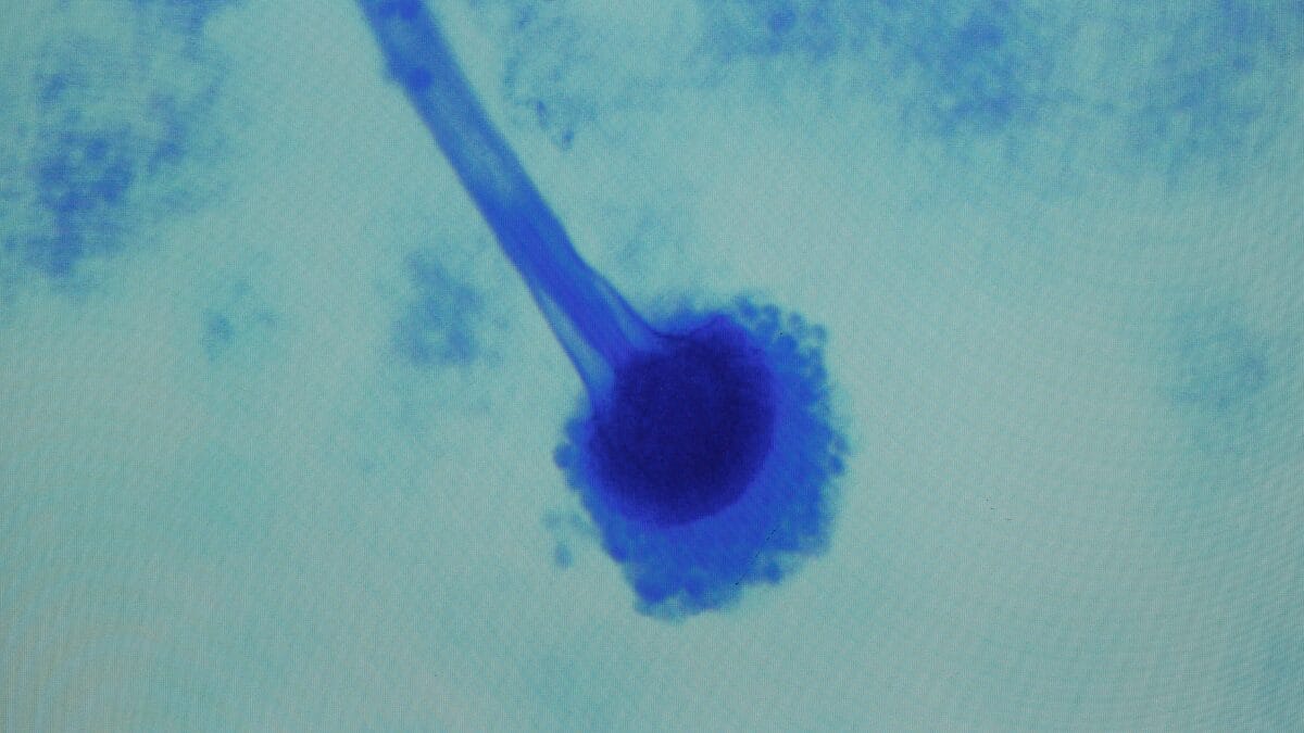 Fungo