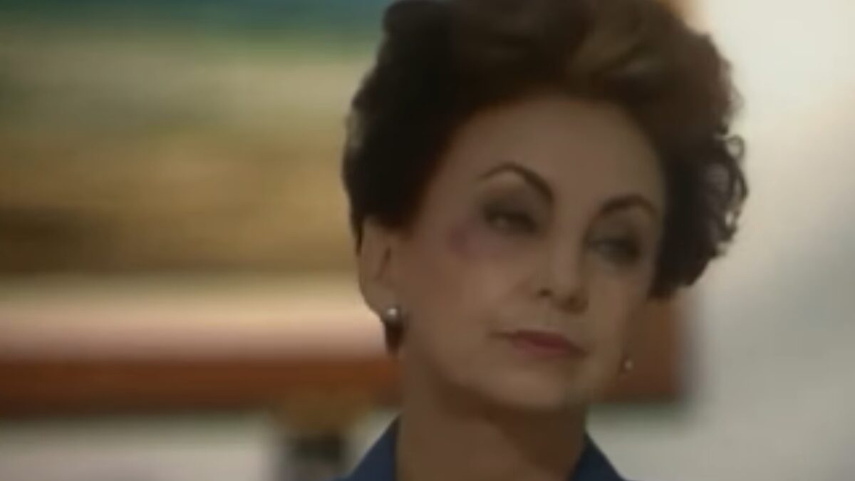 Odete Roitman mostra o olho roxo e diz que caiu Vale Tudo