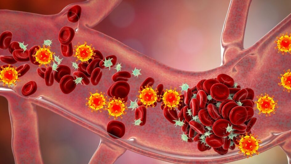 Diagnóstico precoce de trombofilia evita complicações graves (Imagem: Kateryna Kon | Shutterstock)