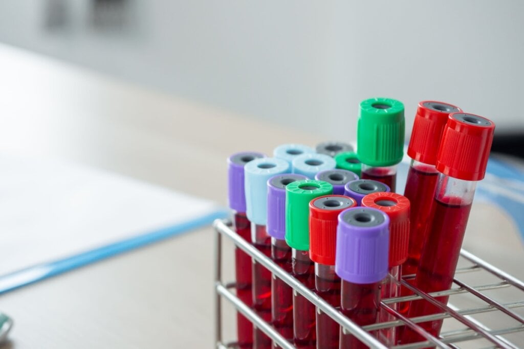 A trombofilia pode ser diagnosticada por meio de exames de sangue específicos que avaliam mutações genéticas (Imagem: Photoroyalty | Shutterstock)