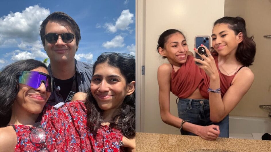 As gêmeas siamesas mexicanas Carmen e Lupita Andrade