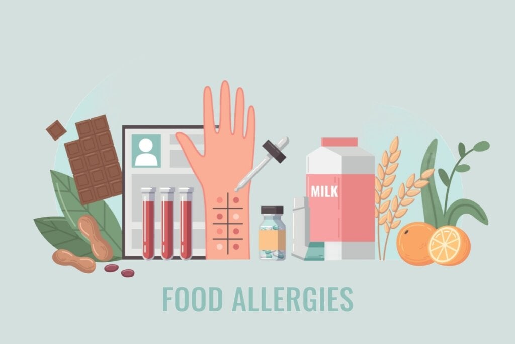 IlustraÃ§Ã£o com alimentos que podem causar alergia alimentar, leite, glÃºten, chocolate e frutas e uma mÃ£o com teste de alergia em pontos