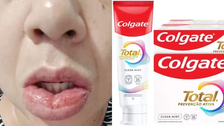 colgate