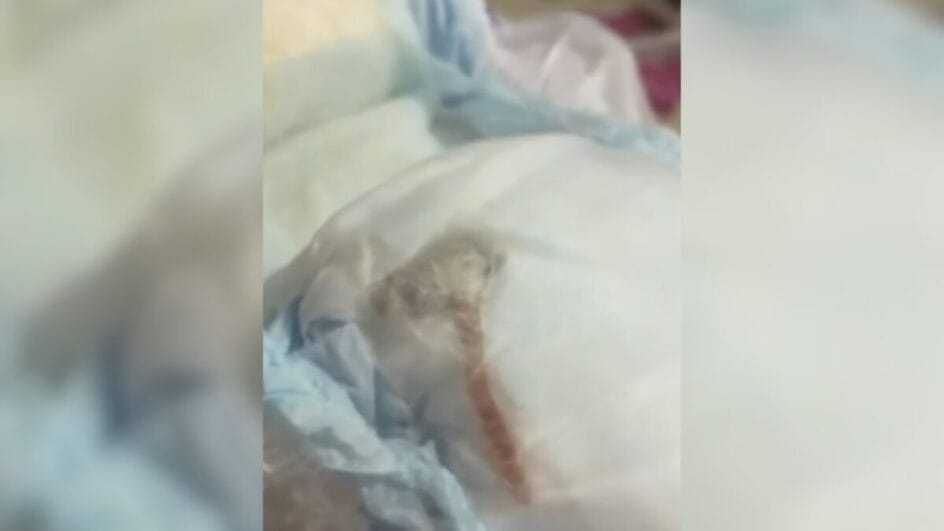 Mãe da criança encontrou sangue do animal morto na fralda (Foto: Bom Dia Rio, TV Globo, Reprodução)