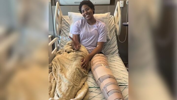 Ana Cristina após cirurgia para reparar lesão no menisco do joelho esquerdo