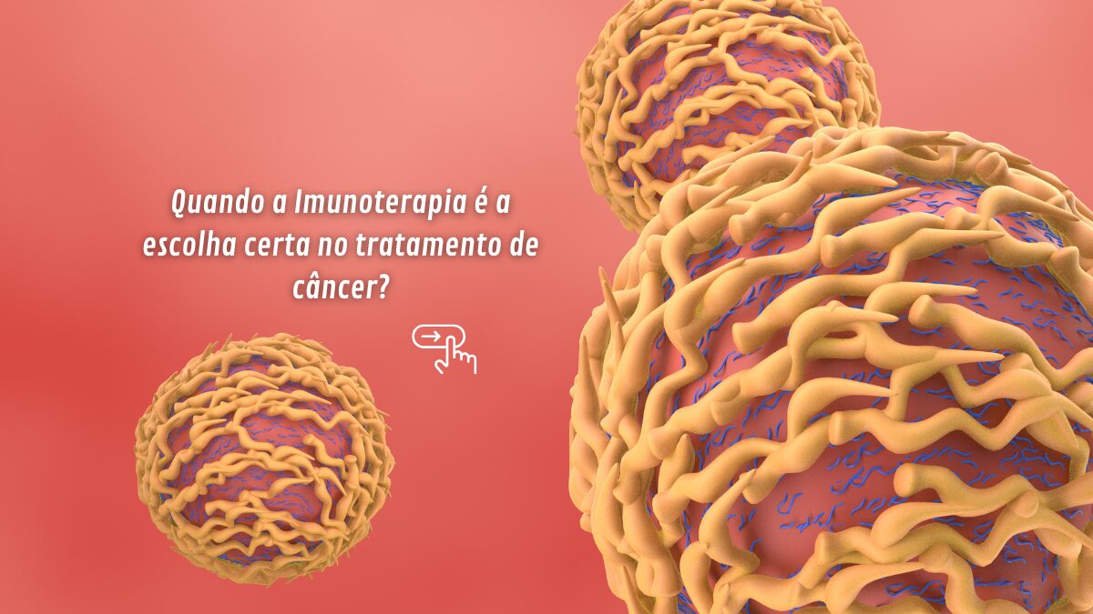 Quando a Imunoterapia é a escolha certa no tratamento de câncer de cabeça e pescoço