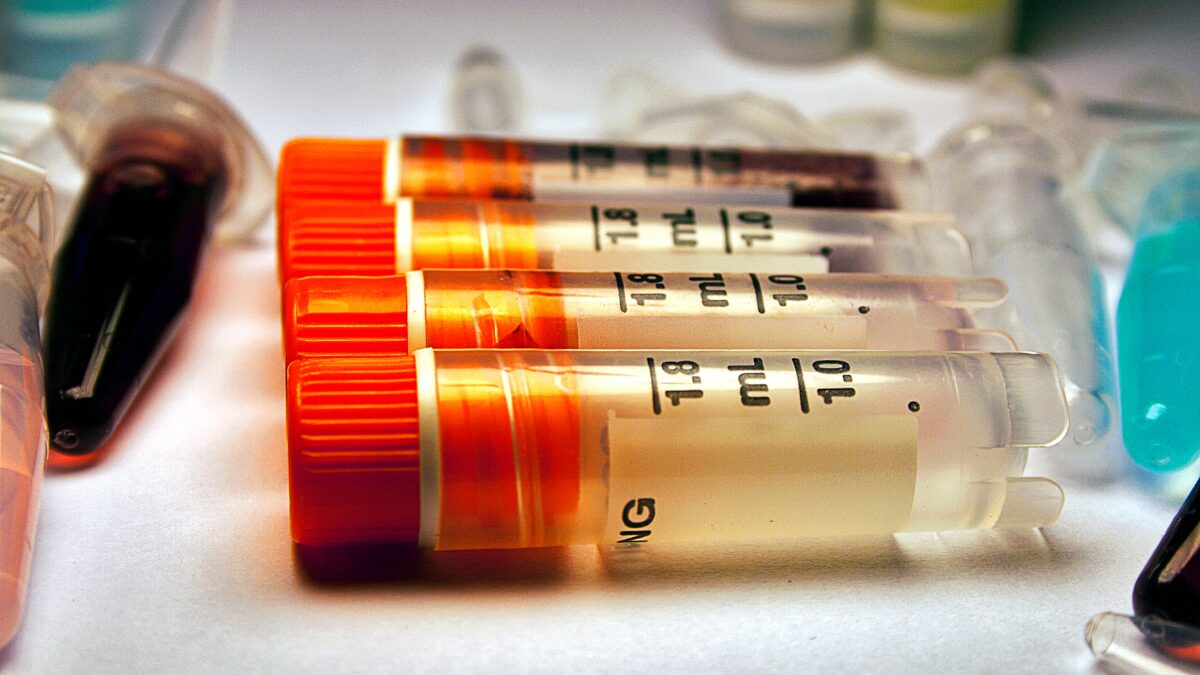 Testes moleculares ajudam a identificar pacientes que podem se beneficiar