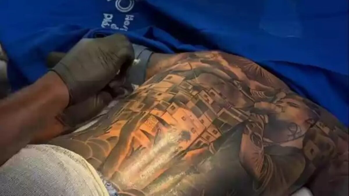 Uso de anestesia geral e sedação para realização de tatuagens está proibido; entenda