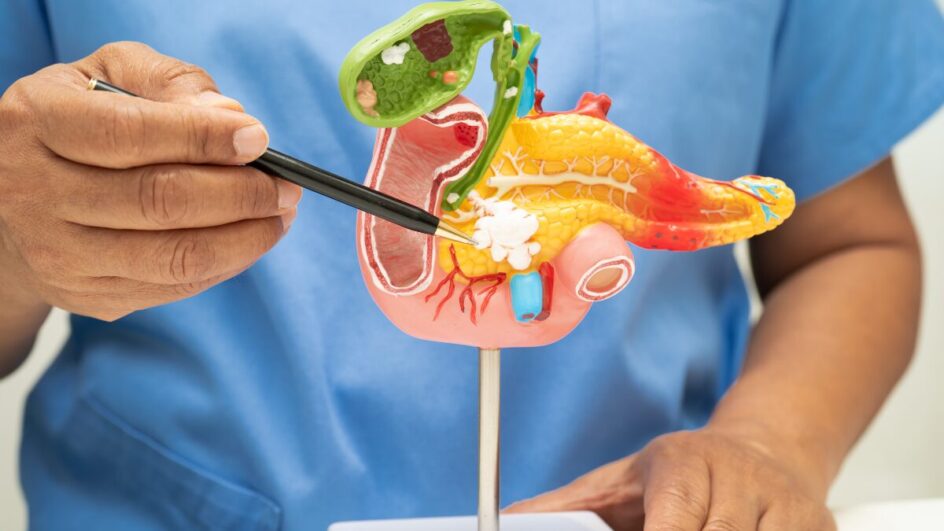 Câncer de pâncreas costuma ser letal (Foto: Banco de Imagens)