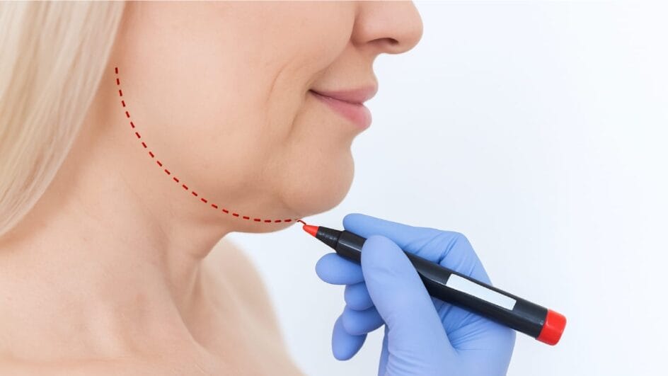 Descubra os segredos para uma silhueta facial mais definida e diga adeus à gordurinha sob o queixo. Imagem gerada por IA