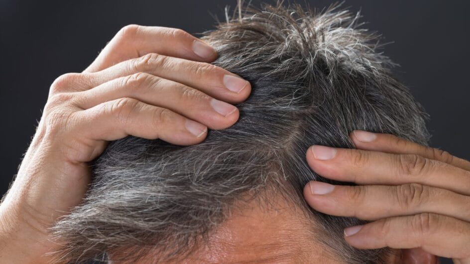 Achou o primeiro fio branco? Nutricionista lista os 9 alimentos que são 'aliados' da cor natural do seu cabelo