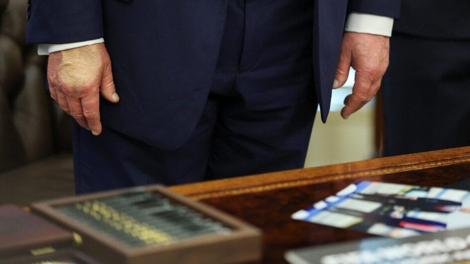 Com diagnóstico de doença crônica, Donald Trump volta a aparecer com as mãos maquiadas