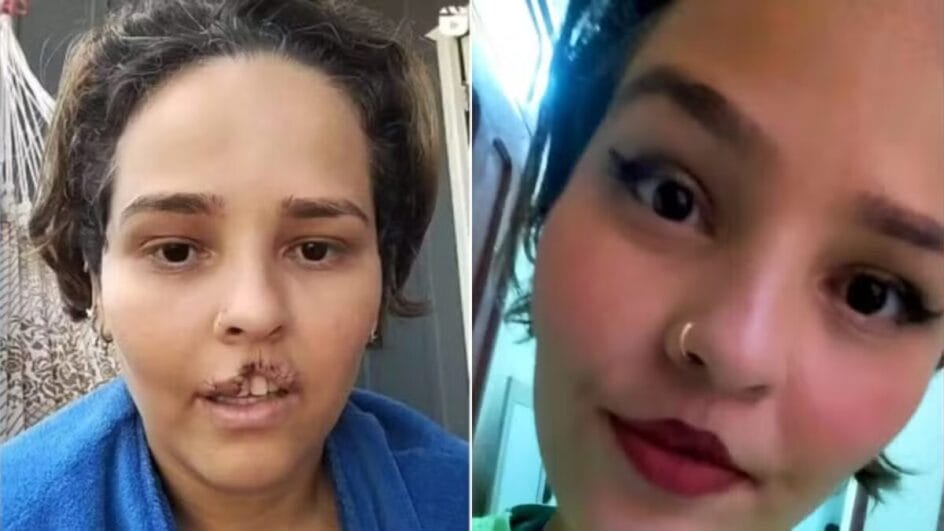 Cirurgia vítima de ataque de chow-chow