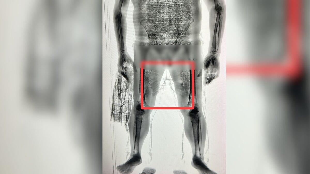 Scanner flagra material suspeito colado nas pernas de pai de detento do presídio de Joinville