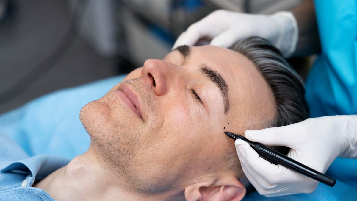 Ginecomastia e lipoaspiração lideram a revolução silenciosa no visual masculino (Foto: Banco de imagens)