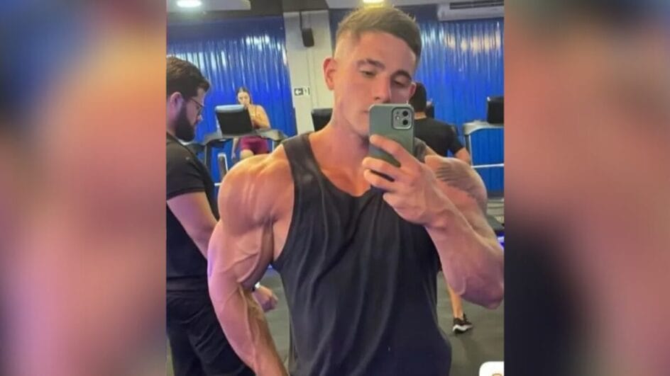 Homem quebrou a mão durante a agressão (Foto: Reprodução)