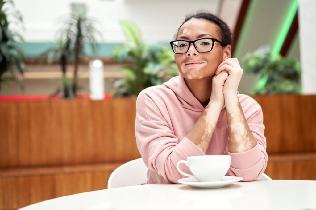 Mulher com vitiligo usando óculos e casaco rosa sentada próximo à uma mesa com xÃcara e pires brancos