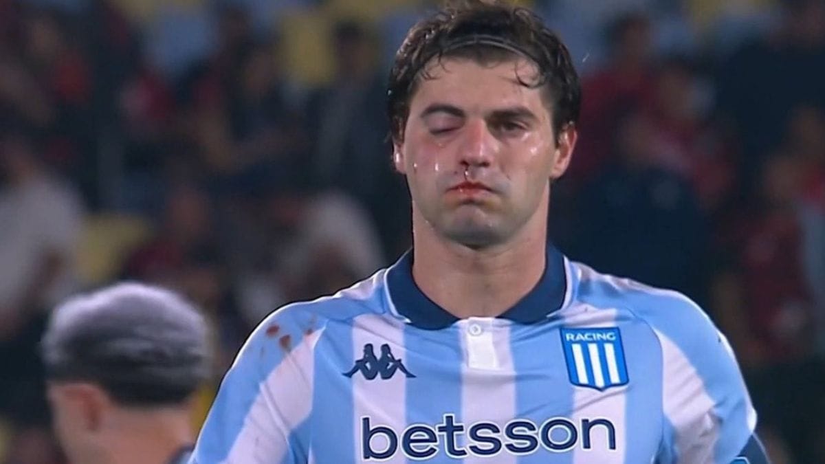 Sosa levou a pior em cotovelada "amiga" contra o Flamengo (Foto: TV Globo, Reprodução)