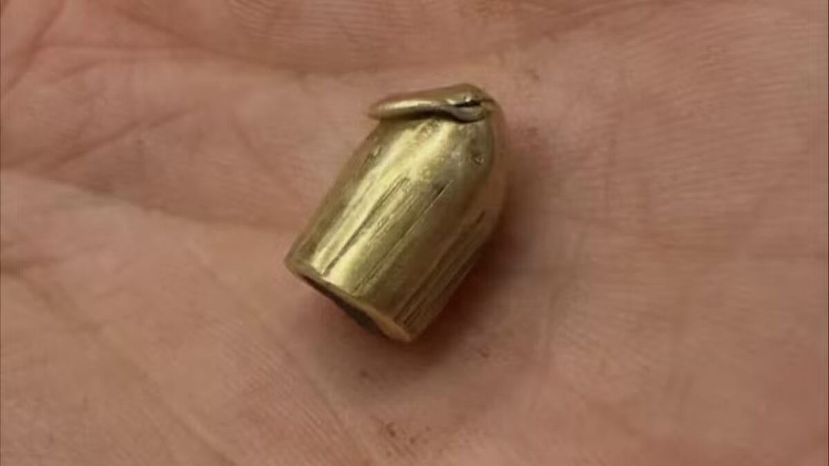 Jogadora exibe projétil que a atingiu em tentativa de assalto na Tijuca