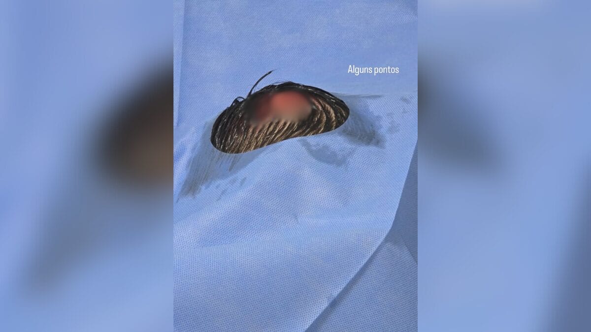 Kayky Brito sofre novo acidente (Foto: Reprodu&ccedil;&atilde;o, Redes sociais)