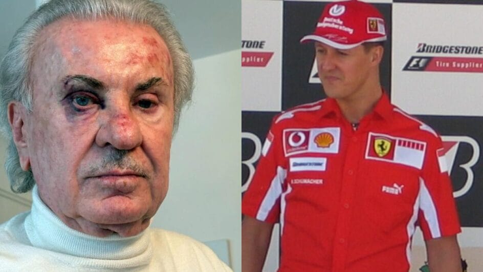 Willi Weber, ex-empresário de Schumacher, com ferimentos no rosto após assalto violento (Foto: Reprodução, Bild e Wikimedia Commons)