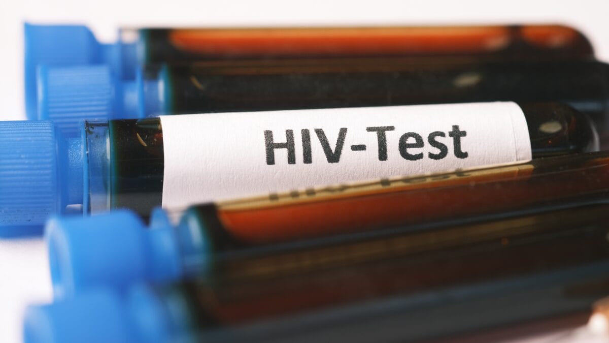 Serão distribuídos testes de HIV (Foto: Banco de imagens)