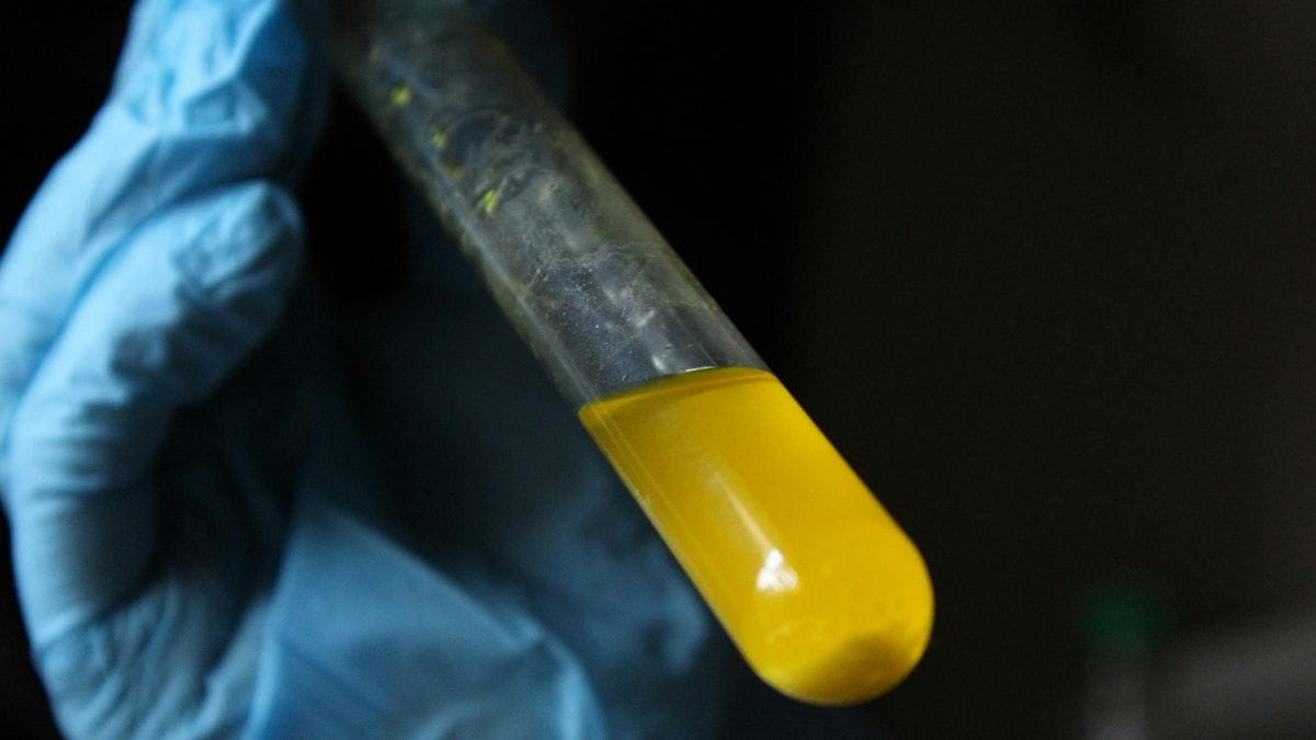 Personaliza&ccedil;&atilde;o em farm&aacute;cias magistrais permite o ajuste de f&oacute;rmulas conforme a necessidade biol&oacute;gica de cada paciente (Foto: Banco de Imagens)