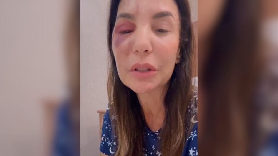 A cantora passou por um episódio de desidratação (Foto: Redes sociais, Reprodução)