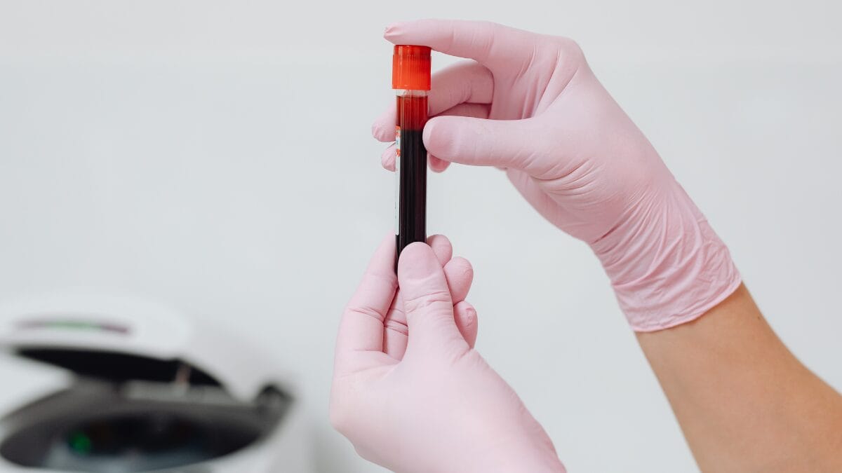 Como funciona o exame de sangue que detecta câncer de mama com 95% de precisão