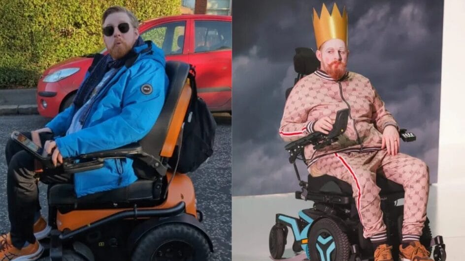 O que é a doença Doença do Neurônio Motor (DNM), que matou ator de Game of Thrones