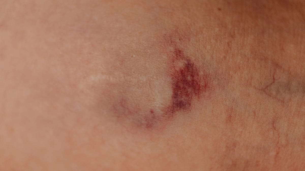 O corpo sente o estresse, e a pele pode dar sinais disso (Foto: Pexels)