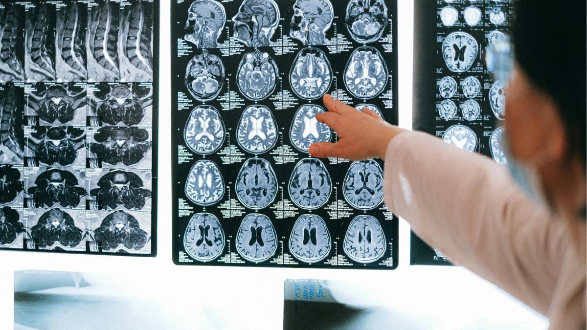 O que acontece com seu cérebro enquanto você rola o feed (Foto: Pexels)