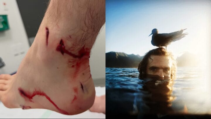 Ed Sloane, fotógrafoio da WSL, ficou gravemente ferido (Foto: Reprodução, Swellnet )