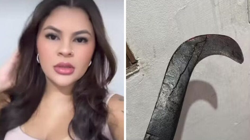Ana Clara de Oliveira está em recuperação após ataque brutal (Foto: Reprodução)