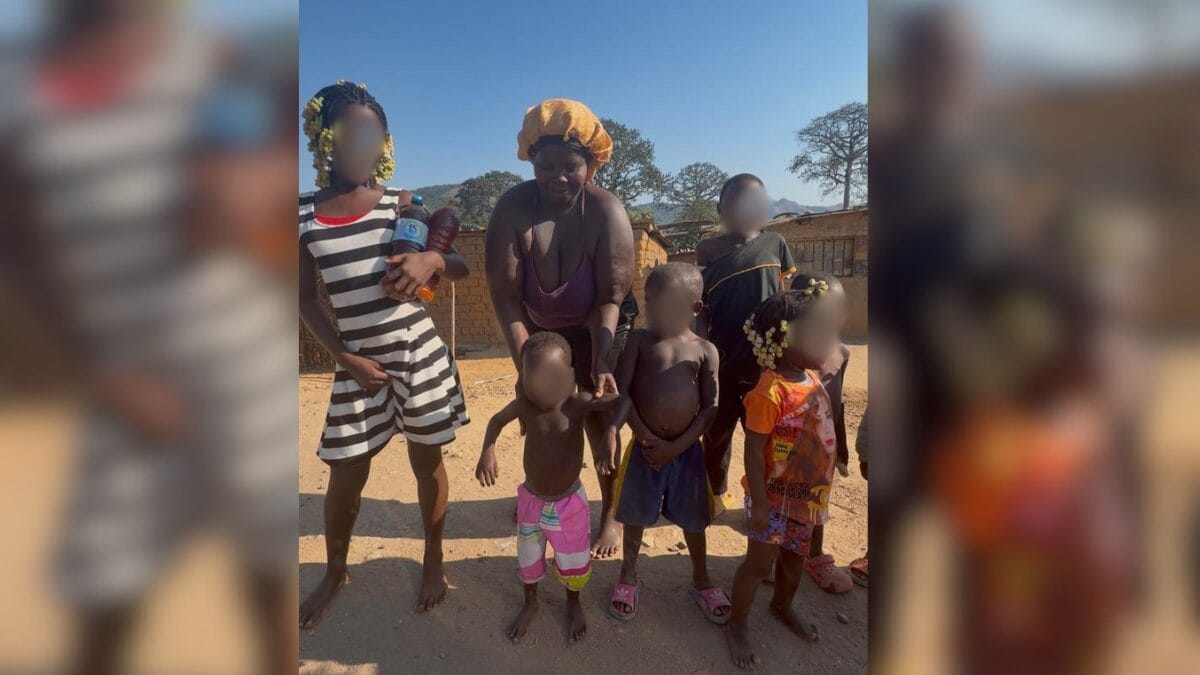 &ldquo;Devolveram o sorrir&rdquo;: a hist&oacute;ria por tr&aacute;s das 80 cirurgias faciais que m&eacute;dico de SC ajudou a fazer na &Aacute;frica