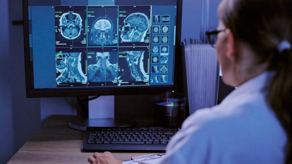 9 sintomas que podem indicar tumor cerebral e merecem avaliação médica