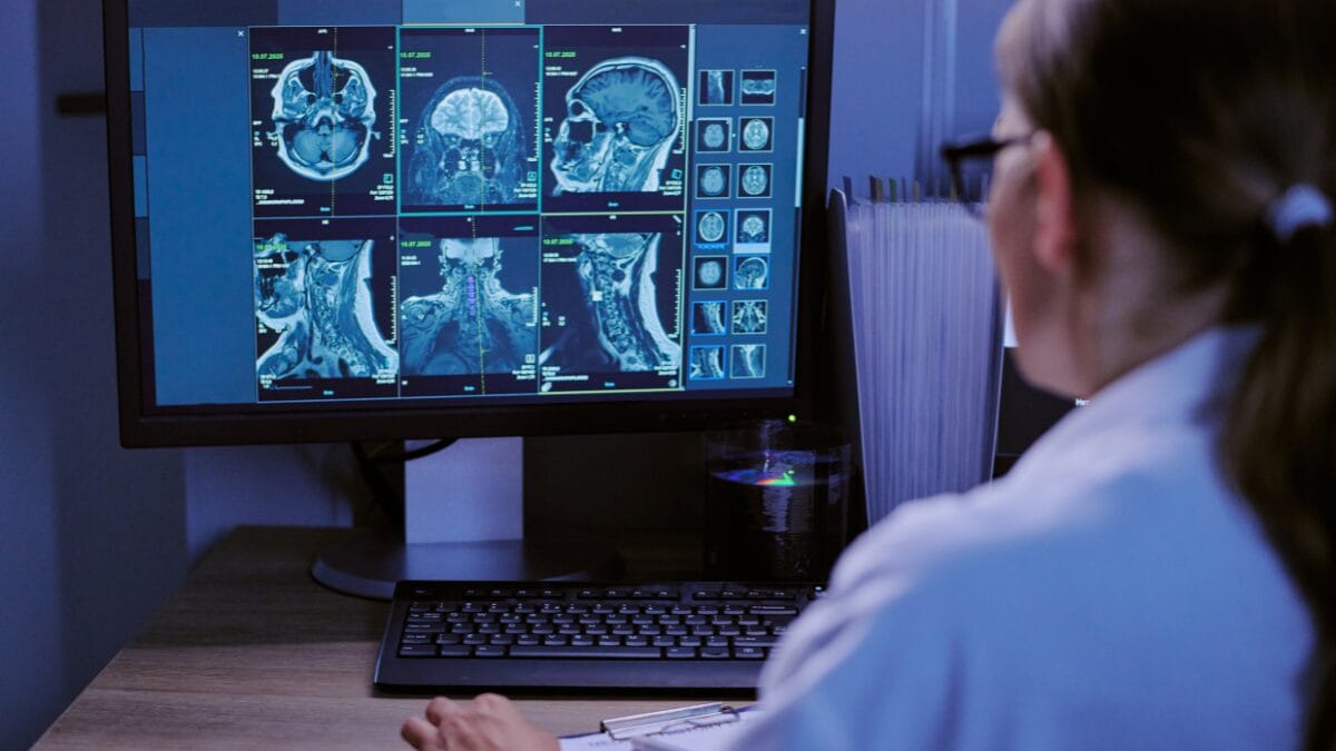 9 sintomas que podem indicar tumor cerebral e merecem avaliação médica