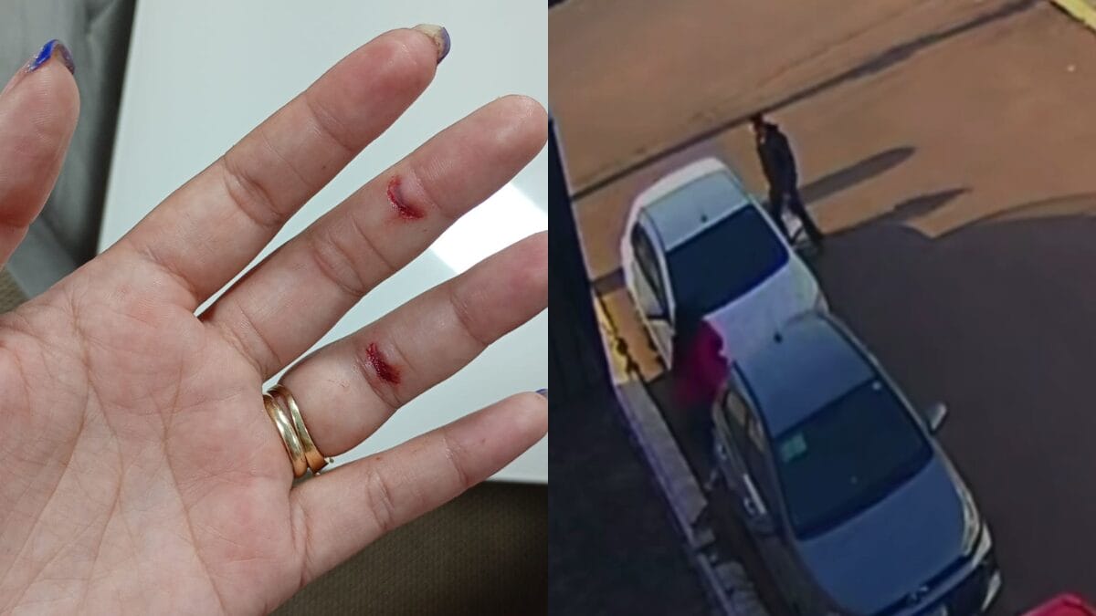 Coordenadora teve ferimentos nas mãos após ataque em Ponte Alta (Foto: Suelen Machado de Souza, Arquivo Pessoal)