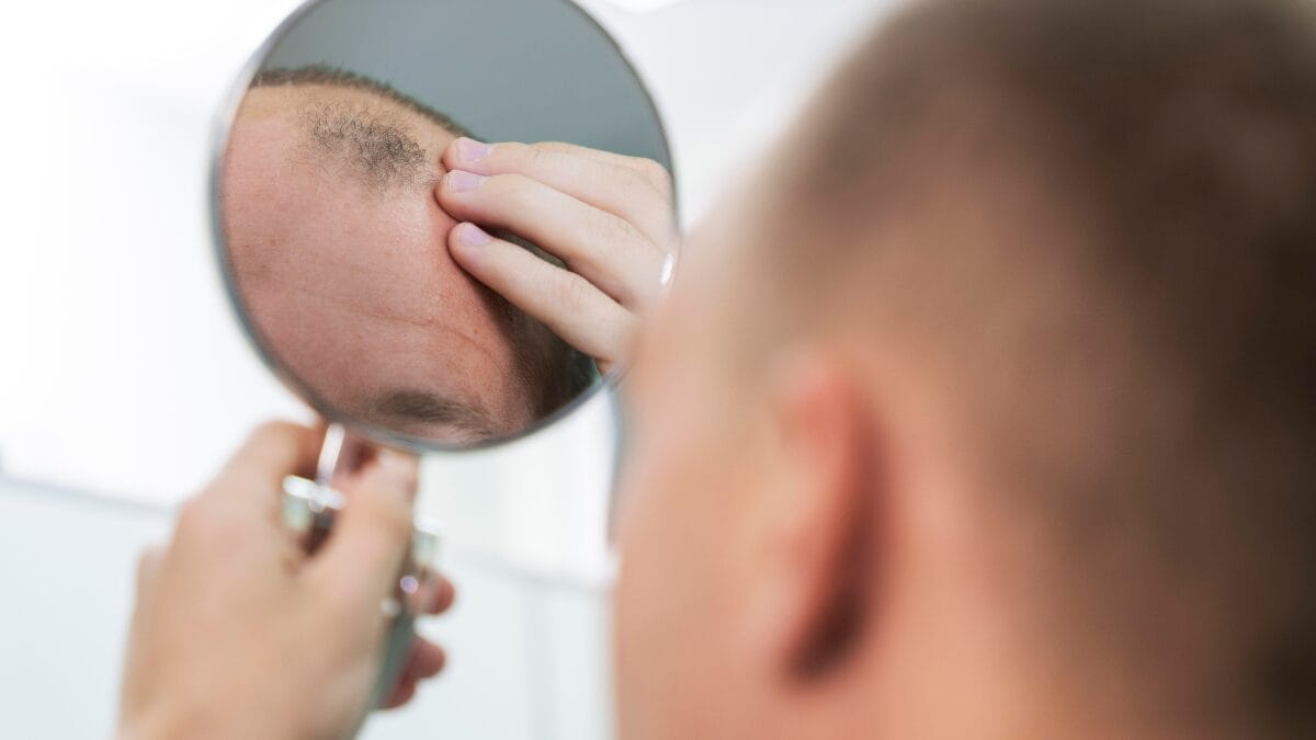 Especialistas recomendam procurar avaliação médica ao notar aumento da queda ou afinamento progressivo dos fios. (Foto: Magnific)
