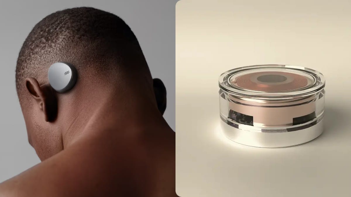 À esquerda, homem com transmissor de sinais atrás da cabeça; na direita, o conceito do chip, do tamanho de uma moeda