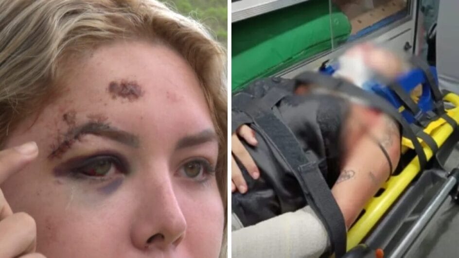 Marcas do atropelamento estão pelo corpo da jovem (Foto: NSC TV, Reprodução; Redes sociais, Reprodução)