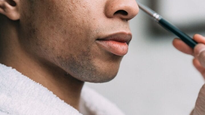 A pele oleosa nem sempre precisa de mais produtos: o equilíbrio é o primeiro passo para uma rotina eficiente (Foto: Pexels)