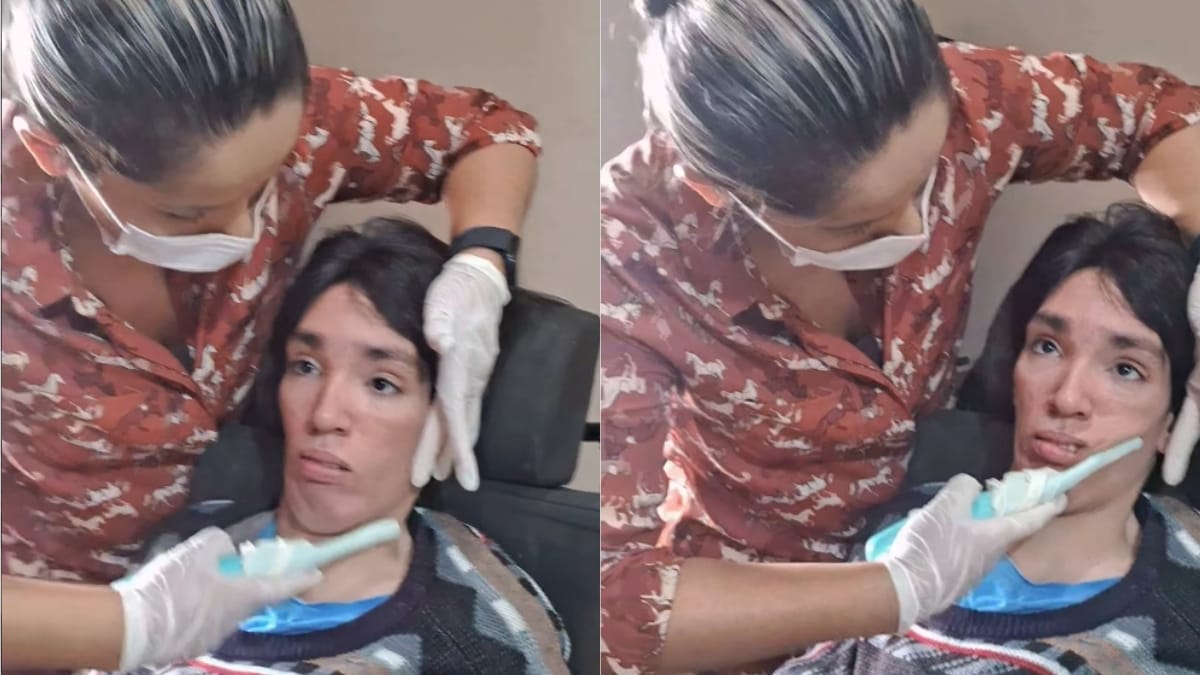 Deyvid em sessão de fonoterapia (Foto: Divulgação, Redes Sociais)