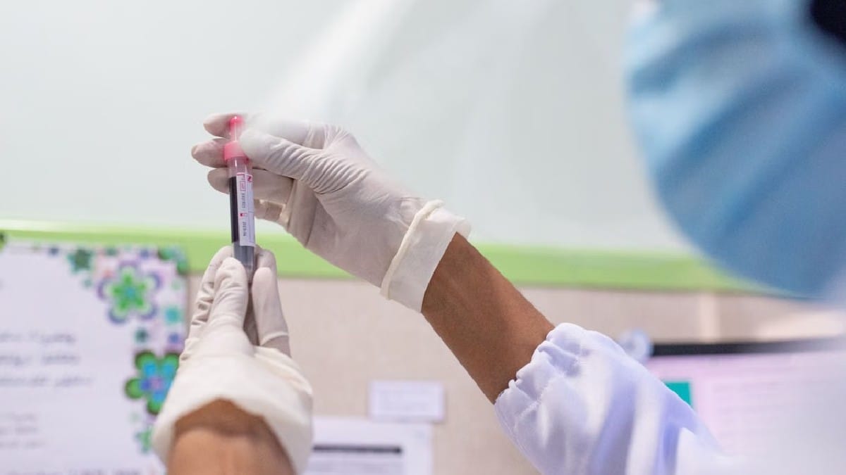 Estudo indica que a apoB pode medir melhor partículas nocivas no sangue e ajudar médicos (Foto: Asad Photo Maldives / Pexels)