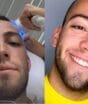 Lucas Rangel compartilha diagnóstico de alopecia após sinais de manchinhas na cabeça