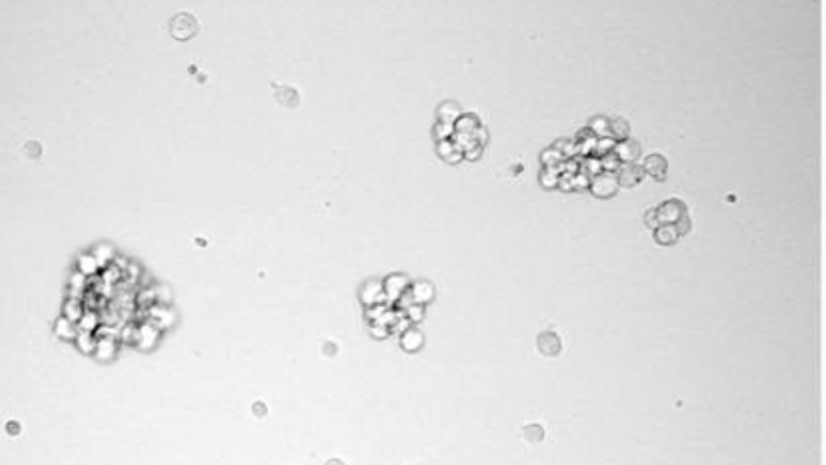 Pesquisadores estudaram o papel da enzima PHGDH na comunicação entre as células cerebrais. (Imagem: Wikimedia Commons)