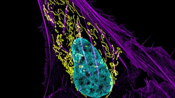 Microbioma tumoral pode inspirar novos tratamentos contra o câncer (Foto: NIH Image Gallery / Wikimedia Commons)