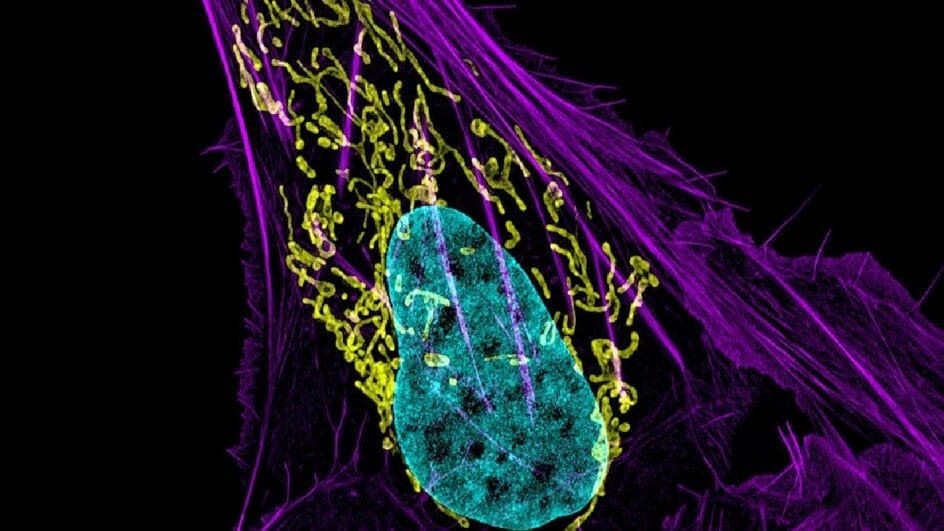 Microbioma tumoral pode inspirar novos tratamentos contra o câncer (Foto: NIH Image Gallery / Wikimedia Commons)