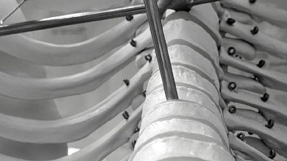 Circuitos da medula espinhal filtram estímulos comuns antes que eles avancem pelas vias associadas à coceira (Foto: Magda Ehlers / Pexels)